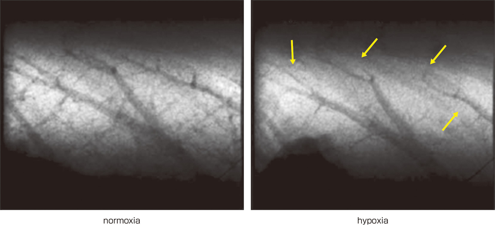 ⓔ図10-10-3　HPVの様子を示すSPring–8で撮影されたラットのmicroangiography（Shirai M, Schwenke DO, et al: Cir Res, 2013; 112: 209–221） 肺胞低酸素では，矢印で示す血管径200～300 μmの肺小動脈の領域で，明らかなHPVが生じている．