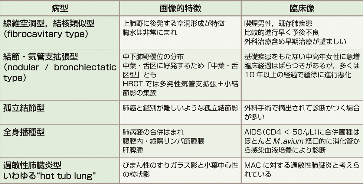 ⓔ表10-2-8　肺NTM症の病型と画像所見 (中川 拓，小川賢二：日本内科学会雑誌，2010; 99: 2709–2714) 