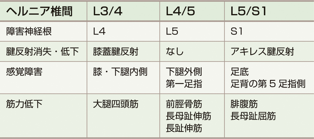 ⓔ表18-18-1　腰椎椎間板ヘルニア (後外側型) の高位別の神経症候 