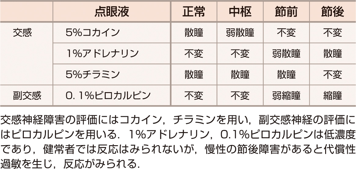 ⓔ表18-4-1　点眼試験薬による瞳孔反応と病変部位 